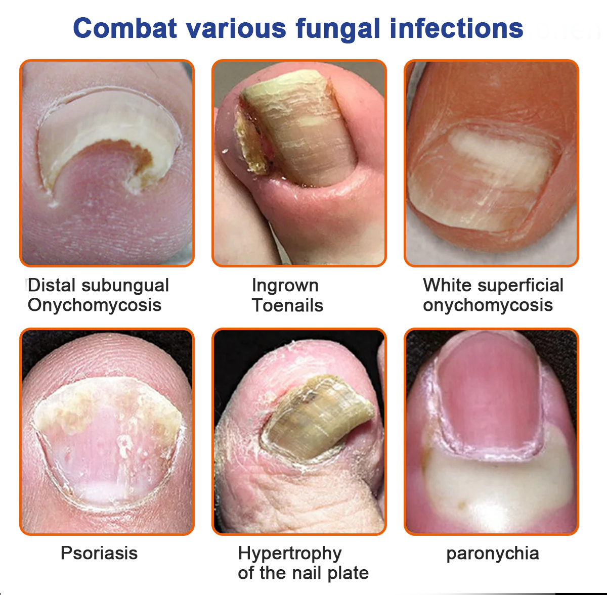 KUBOZNĀ® Bee Venom Nail Fungus Treatment Solutionš£