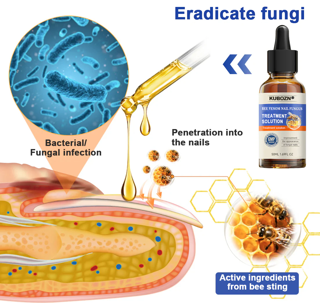 KUBOZNĀ® Bee Venom Nail Fungus Treatment Solutionš£