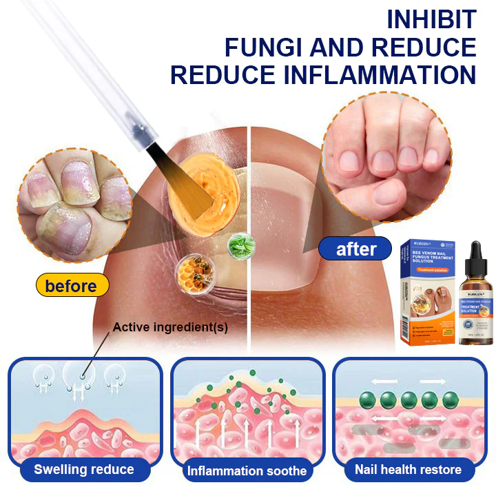 KUBOZNĀ® Bee Venom Nail Fungus Treatment Solutionš£