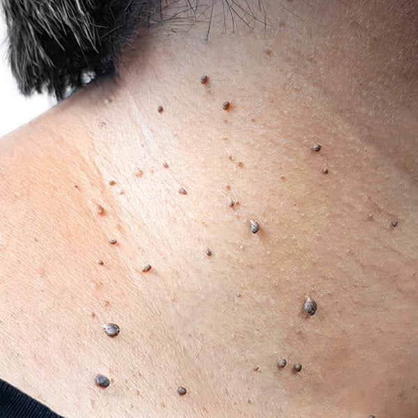 KUBOZN® Pro MicroDarts TAG'Gone Patch 19 gempages 557169870370767934 4a82141d ca97 4f3b 83ea e6ed95a53010