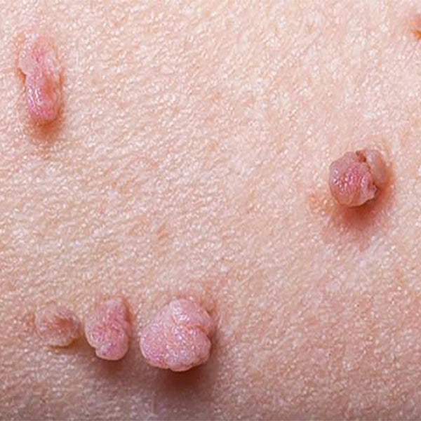 KUBOZN® Pro MicroDarts TAG'Gone Patch 18 gempages 557169870370767934 568b378e 3478 4506 b7db 62204d970cda