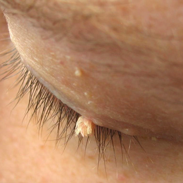 KUBOZN® Pro MicroDarts TAG'Gone Patch 20 gempages 557169870370767934 5b434a43 fecb 4d14 b3c5 b0b331a125bd