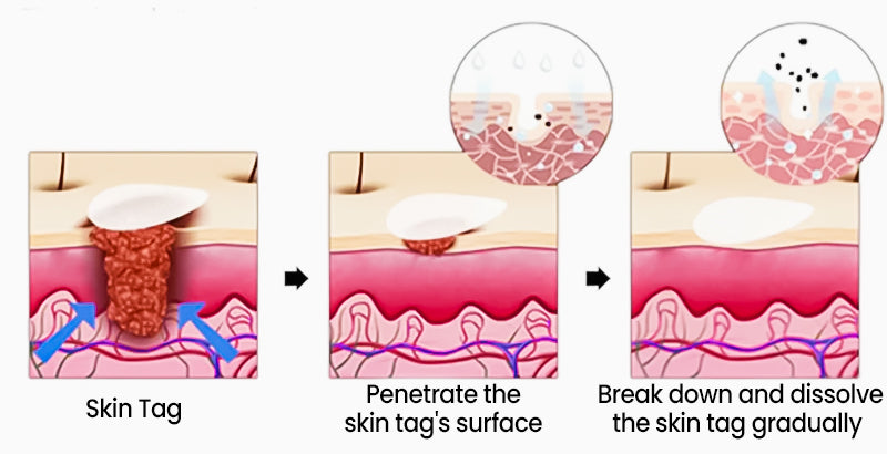 KUBOZN® Pro MicroDarts TAG'Gone Patch 23 Alt Image
