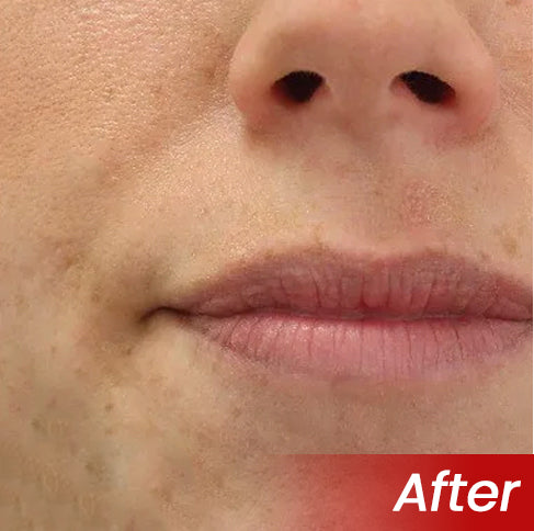 KUBOZN® Pro MicroDarts TAG'Gone Patch 21 gempages 557169870370767934 9dd90a95 dcbf 4459 a0c2 f5ffa92025f1