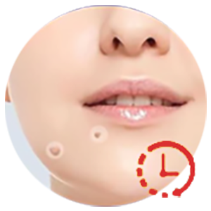 KUBOZN® Pro MicroDarts TAG'Gone Patch 26 gempages 557169870370767934 e73fe93f fb18 4a6d 8363 7d73af4cf820