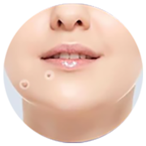 KUBOZN® Pro MicroDarts TAG'Gone Patch 25 gempages 557169870370767934 fbb142f8 7122 40ea a524 c43d270186d7