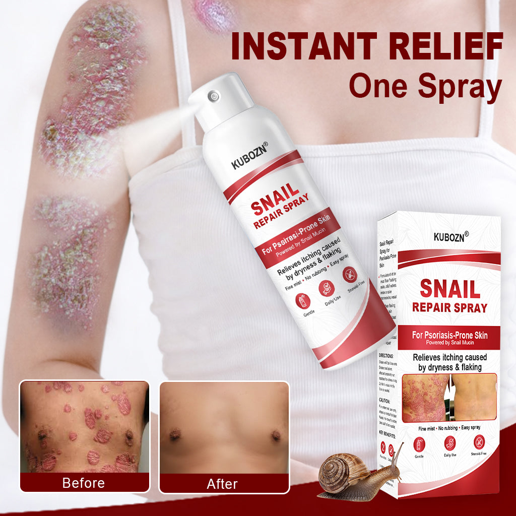 KUBOZN® Snail Repair Spray for Itchy, Flaky Psoriasis Skin (offer)