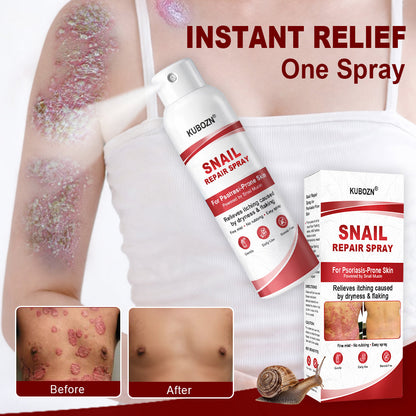 KUBOZN® Snail Repair Spray for Itchy, Flaky Psoriasis Skin (offer)