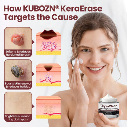 KUBOZN®KeraErase Dual-Action Renewal Cream