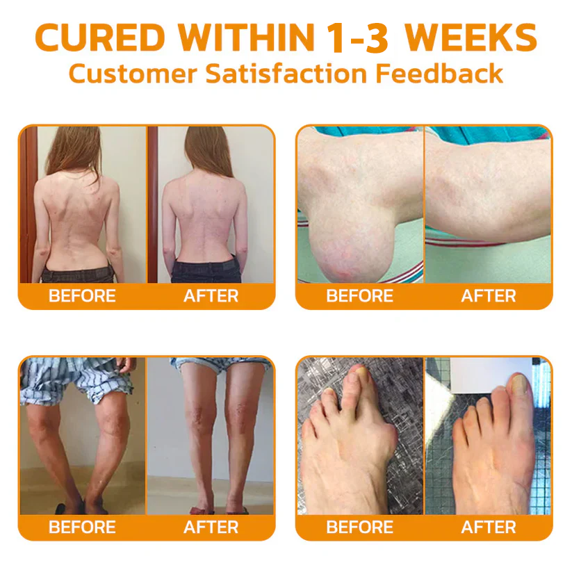 AU🏅  KUBOZN® MagniVen Magnesium & Bee Venom Joint Spray – 5 Min Relief · 7 Day Mobility · 4 Week Comfort