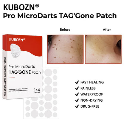 ✨ KUBOZN® Pro MicroDarts TAG'Gone Patch (offer)