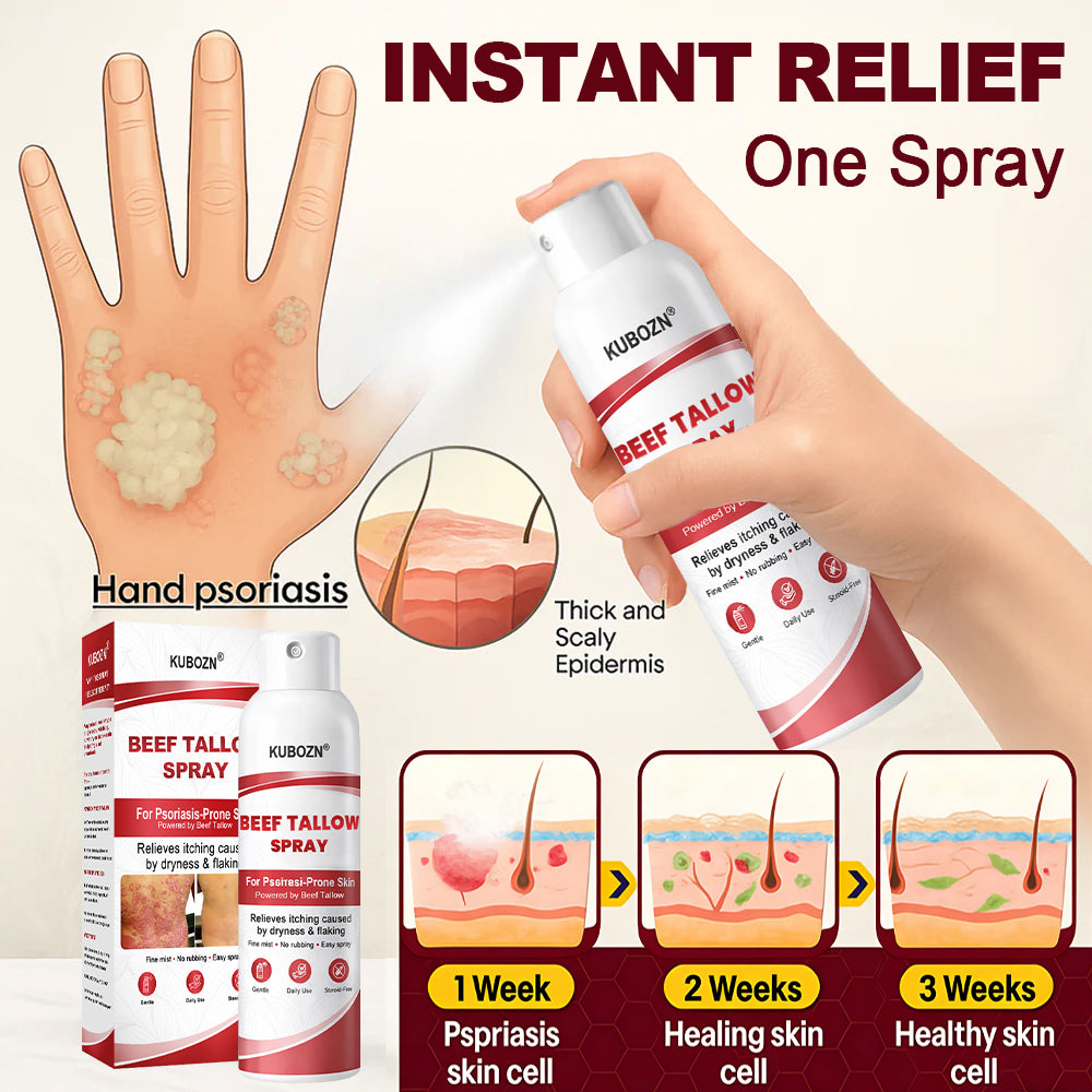 KUBOZN® Beef Tallow Spray for Itchy, Flaky Psoriasis Skin