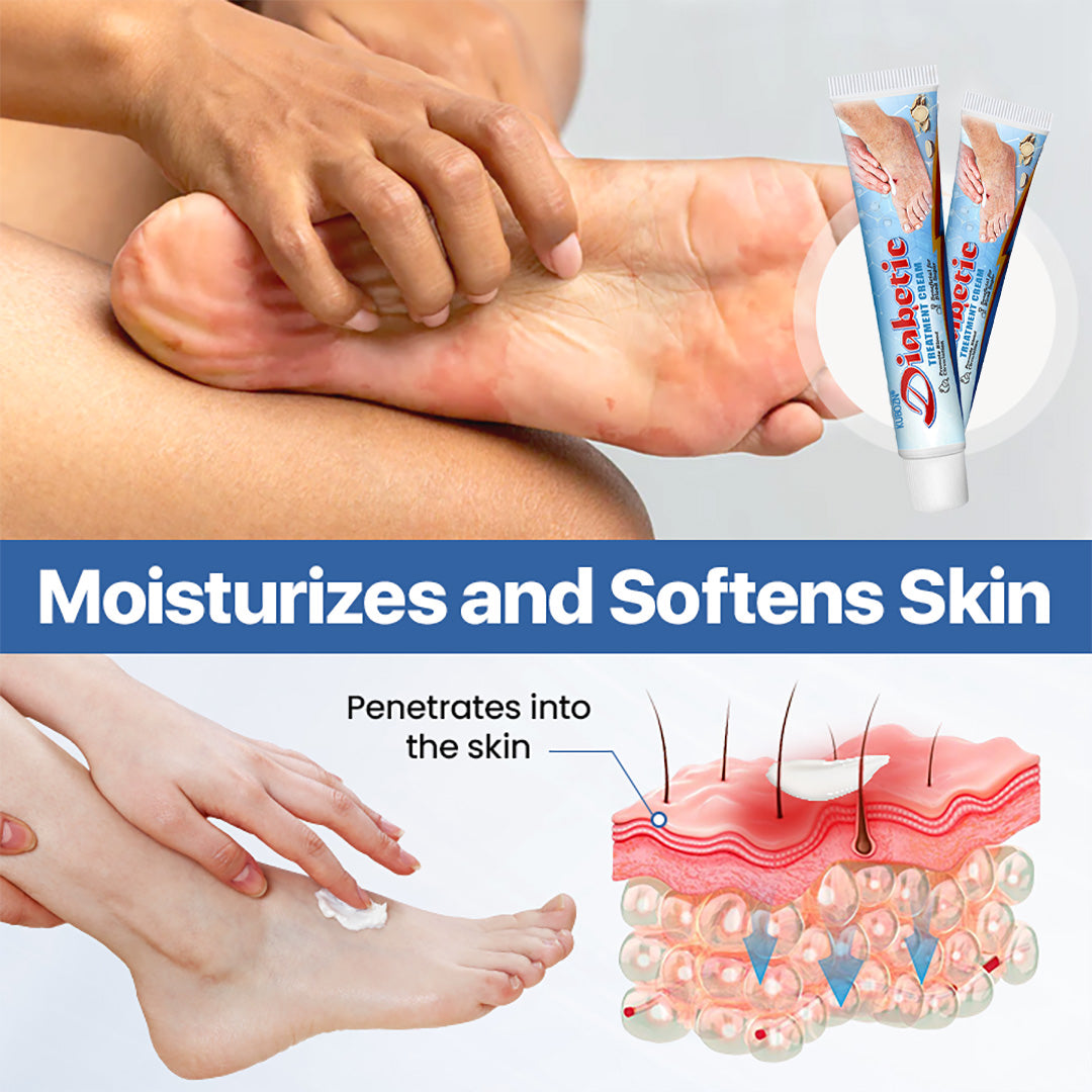 KUBOZN® VitaGluco Diabetes Treatment Cream -👨‍⚕️ Expert-Backed Relief for Aussie Diabetic Skin