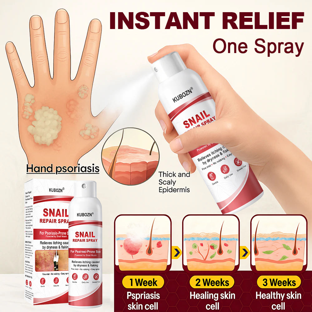 KUBOZN® Snail Repair Spray for Itchy, Flaky Psoriasis Skin (offer)