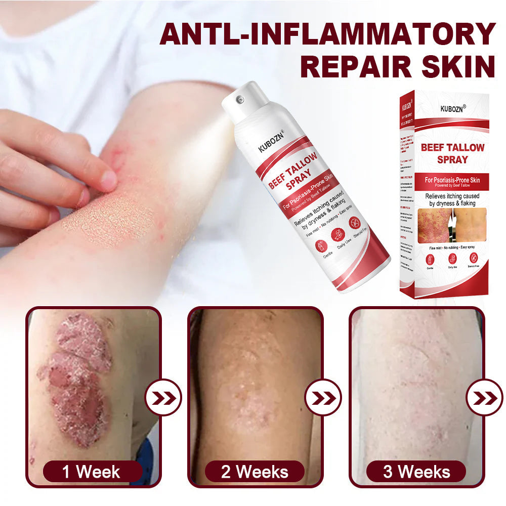 KUBOZN® Beef Tallow Spray for Itchy, Flaky Psoriasis Skin