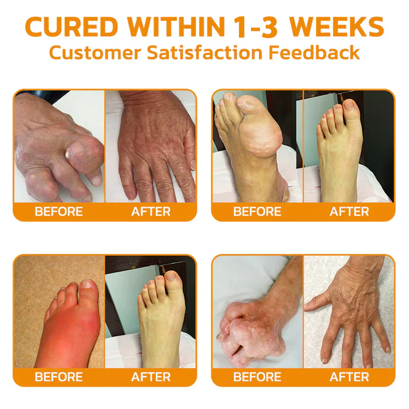 AU🏅  KUBOZN® MagniVen Magnesium & Bee Venom Joint Spray – 5 Min Relief · 7 Day Mobility · 4 Week Comfort