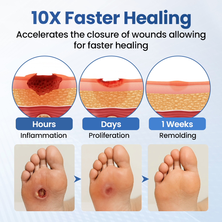 Healrize® GlucoDerm Barrier Spray (offer)