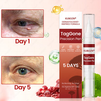✨KUBOZN® TagGone Precision Pen (2025 Upgrade) | Skin Tag, Mole & Wart Remover – Fast, Gentle & Scar-Free in 5 Days (offer)