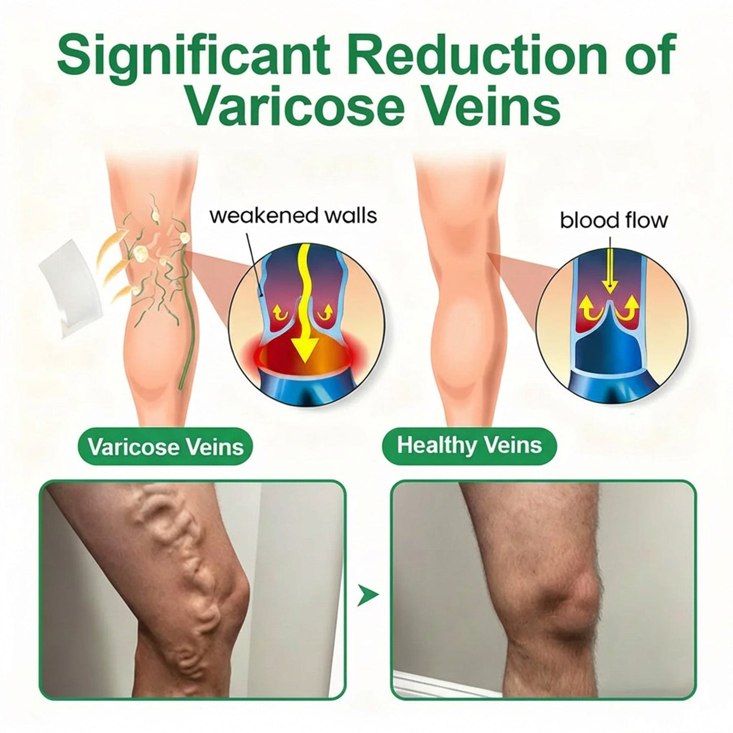 👨‍⚕️🔥Healrize® VeinEase Microneedle Care Patch⚡Instant Relief, Long-Term Results