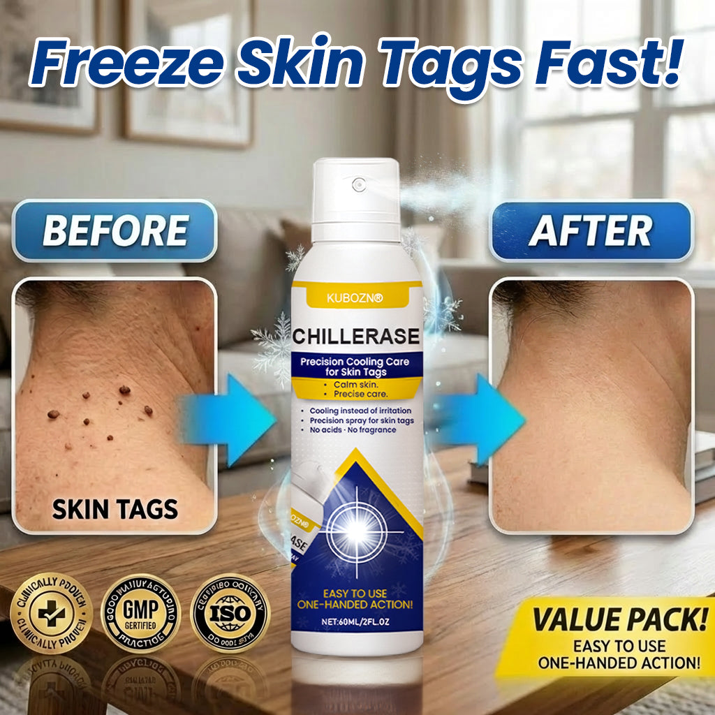 KUBOZN® ChillErase Cooling Spray for Skin Tags
