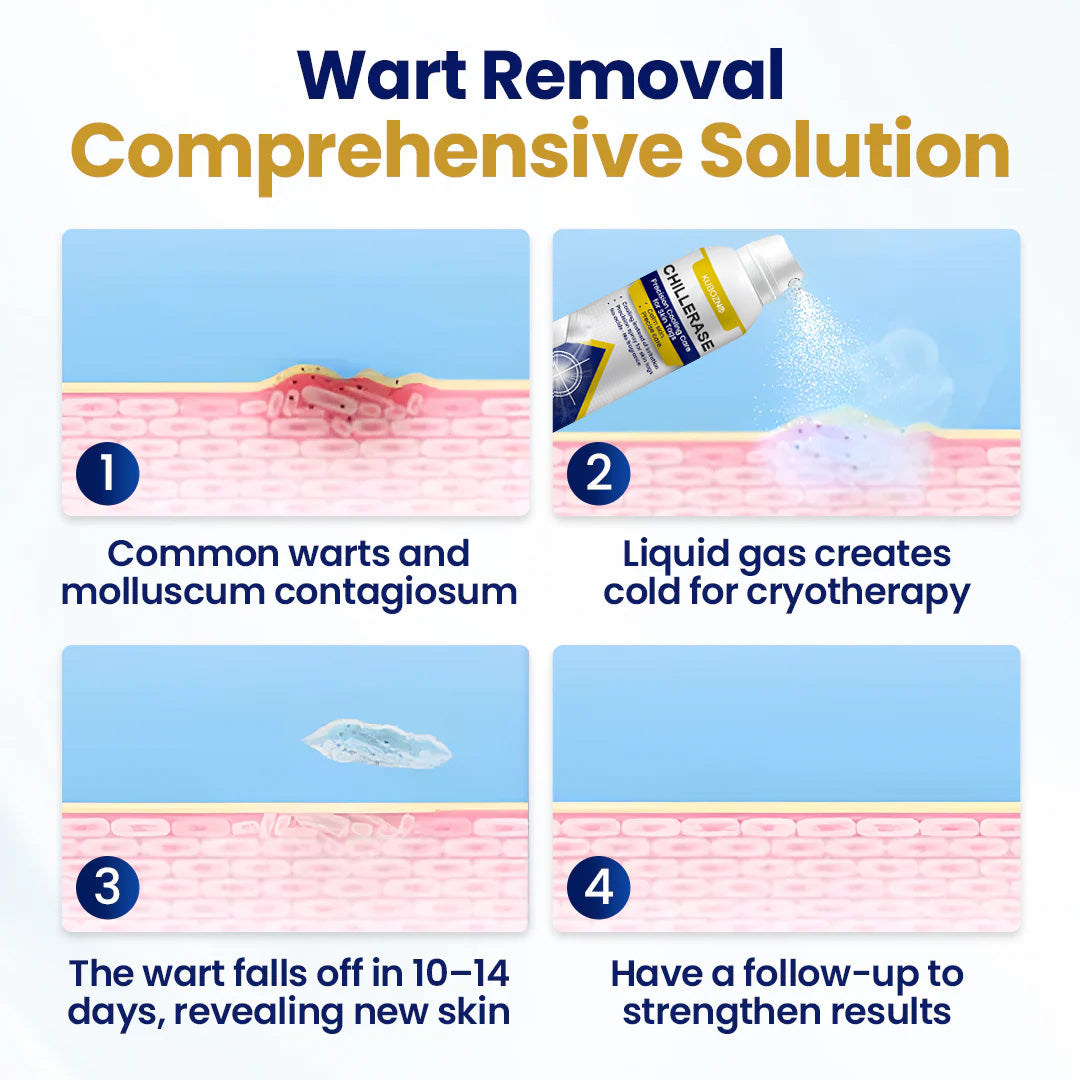 KUBOZN® ChillErase Cooling Spray for Skin Tags