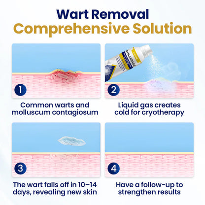 KUBOZN® ChillErase Cooling Spray for Skin Tags